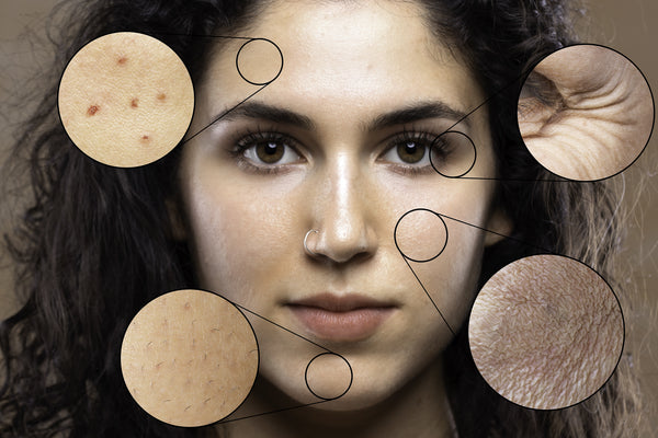 10 Ways the Changing Environment is Changing Your Skin